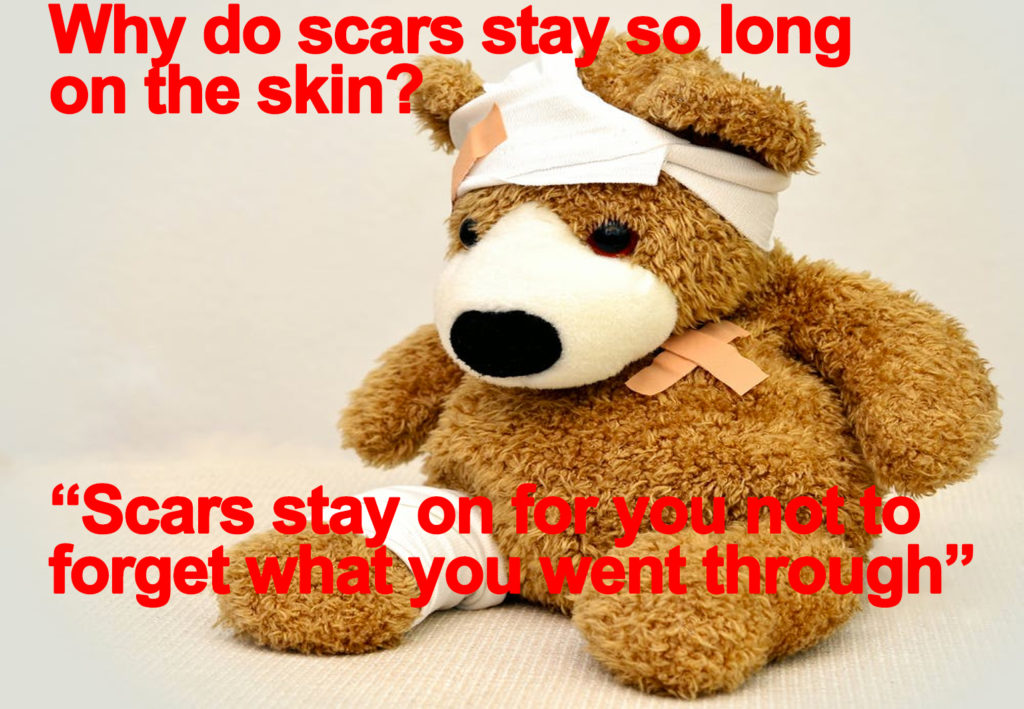 Scars are memo of the past.